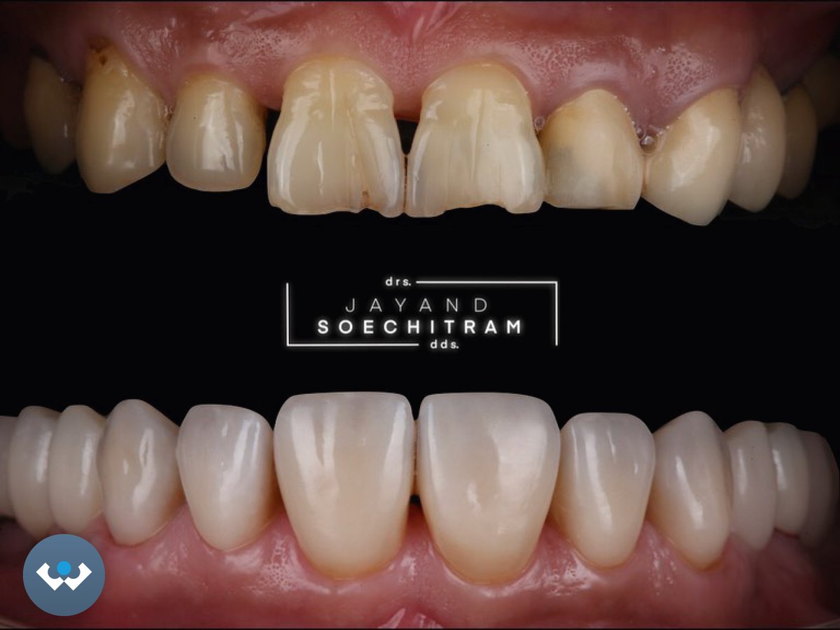 Excent Tandtechniek tweet media