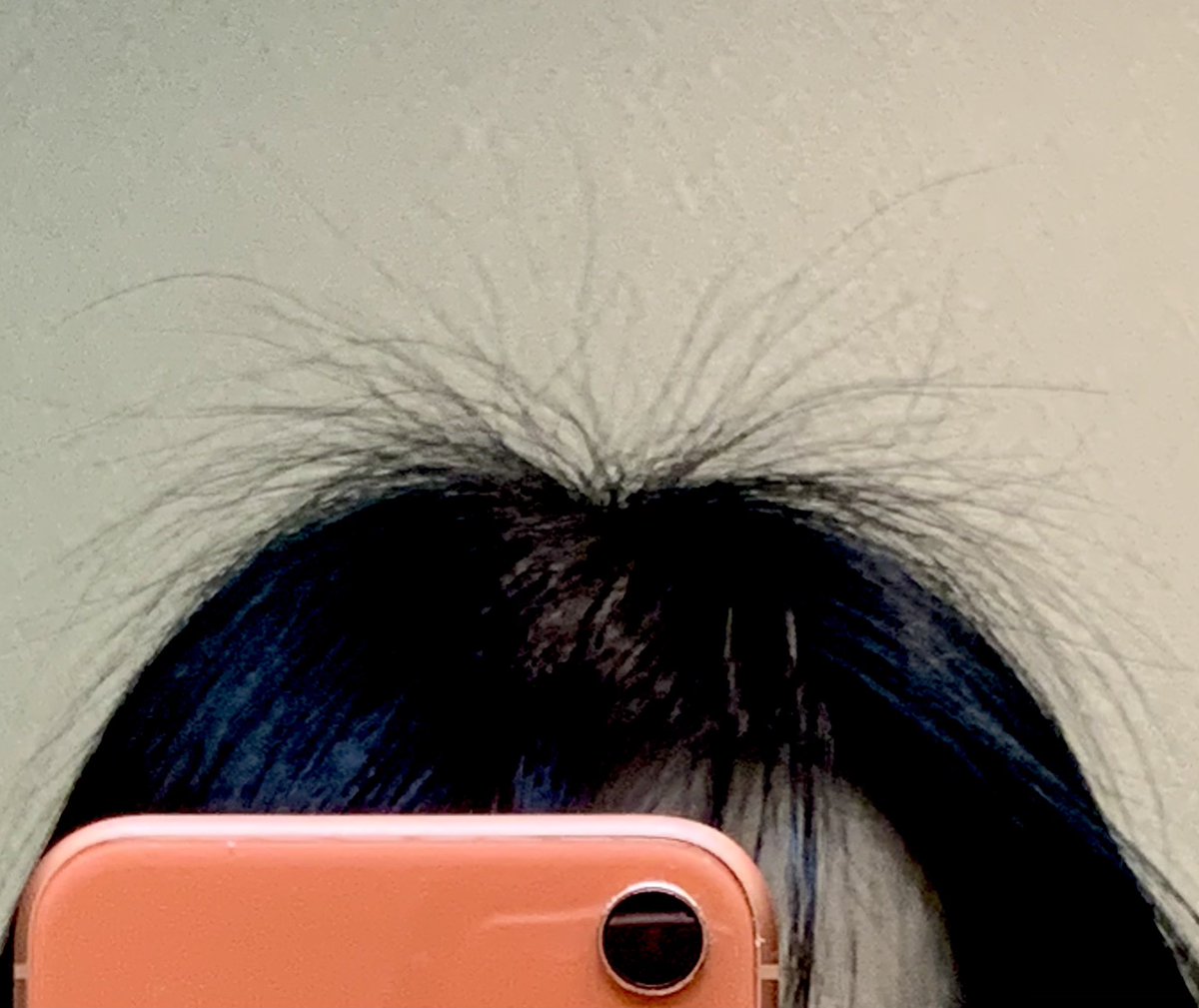 よしこ55歳 筋トレ ボディメイク 毎年秋に大量に髪が抜ける私 春先ちょうどそれが伸びて来るんですが 頭がこんなことに 写ってないけど短い髪の毛もピンピン 髪が硬いからスティックで撫で付けても大して変わらず 早く伸びてくれ 伸びた頃