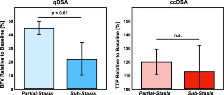 CVIR_Journal's tweet photo. A Quantitative Digital Subtraction #Angiography Technique for Characterizing Reduction in Hepatic Arterial Blood Flow During Transarterial #Embolization | https://t.co/urdQyXJKI0 #IRad https://t.co/c2AmqlcZ7C