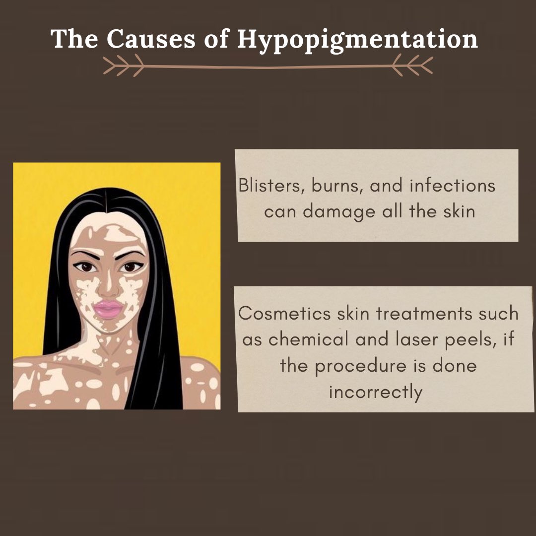 What is hypopigmentation?
It is the loss of skin colour due to a disease or trauma and it can affect people people from birth or develop later in life.

#TrueBeauty #Selflove #AdoraYourself