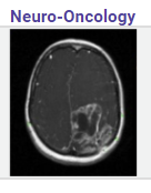 ebrainnet's tweet photo. Reminder: seminars this Sunday at 18:00 GMT for ST1/ST2 and ST3/ST4 trainees. Please log in before 6pm.
- ST1/2 - Ward Management of Neurosurgical Patients, with Mr Ian Coulter.
- ST3/4 - Neuro-Oncology, with Mr Lewis Thorne, Consultant Neurosurgeon, NHNN, London. https://t.co/kluC1Q4ORo