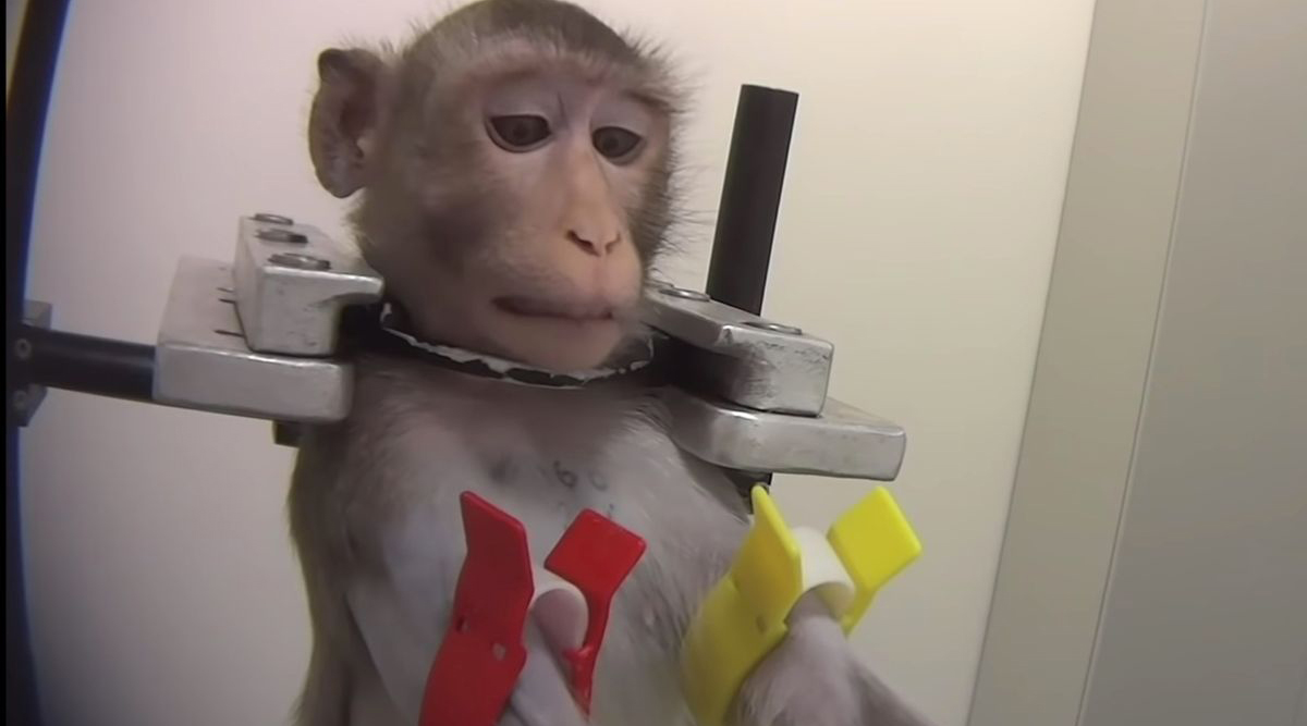 9. Periods of physical restraint for observation or examination. WHY?