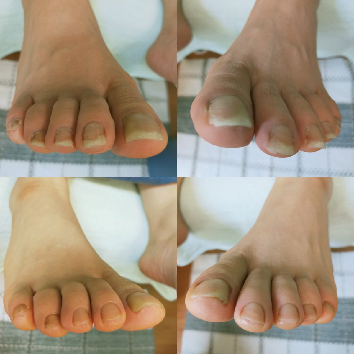 かたい爪 かたい爪