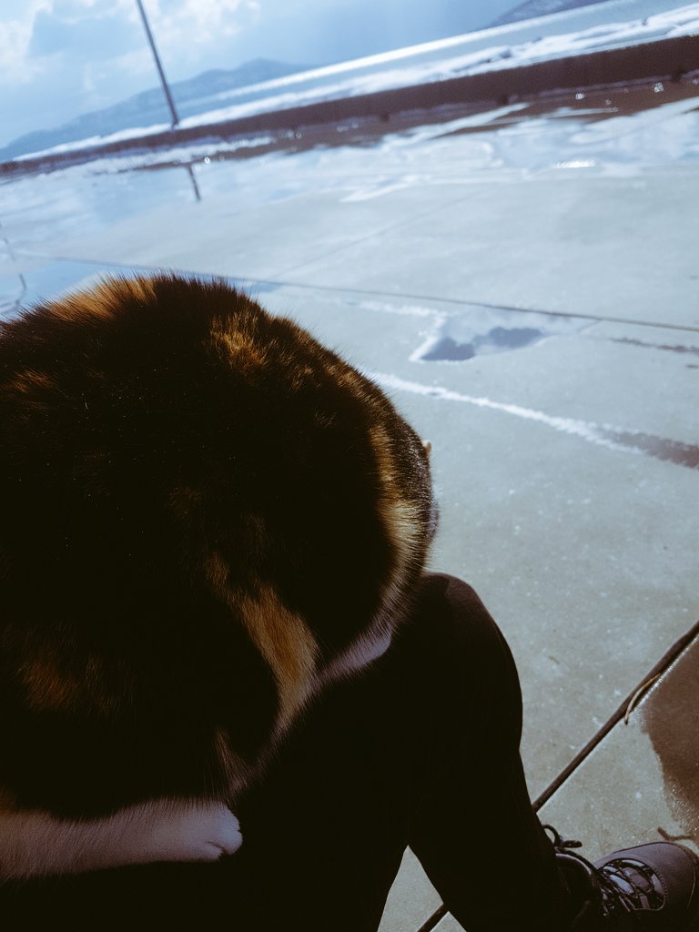 Uyudu bacağımda aq ben bunu nasıl kaldıracam şimdi