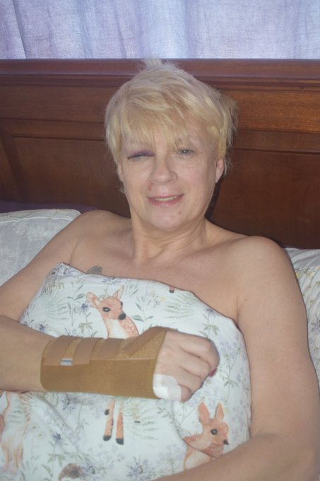 Lieing in bed after my accident yesterday. Need cheering up please send tips to https://t.co/Y9OMEvqPES<a href="/tag/adultwork"class="tags"><span>#adultwork</span></a>