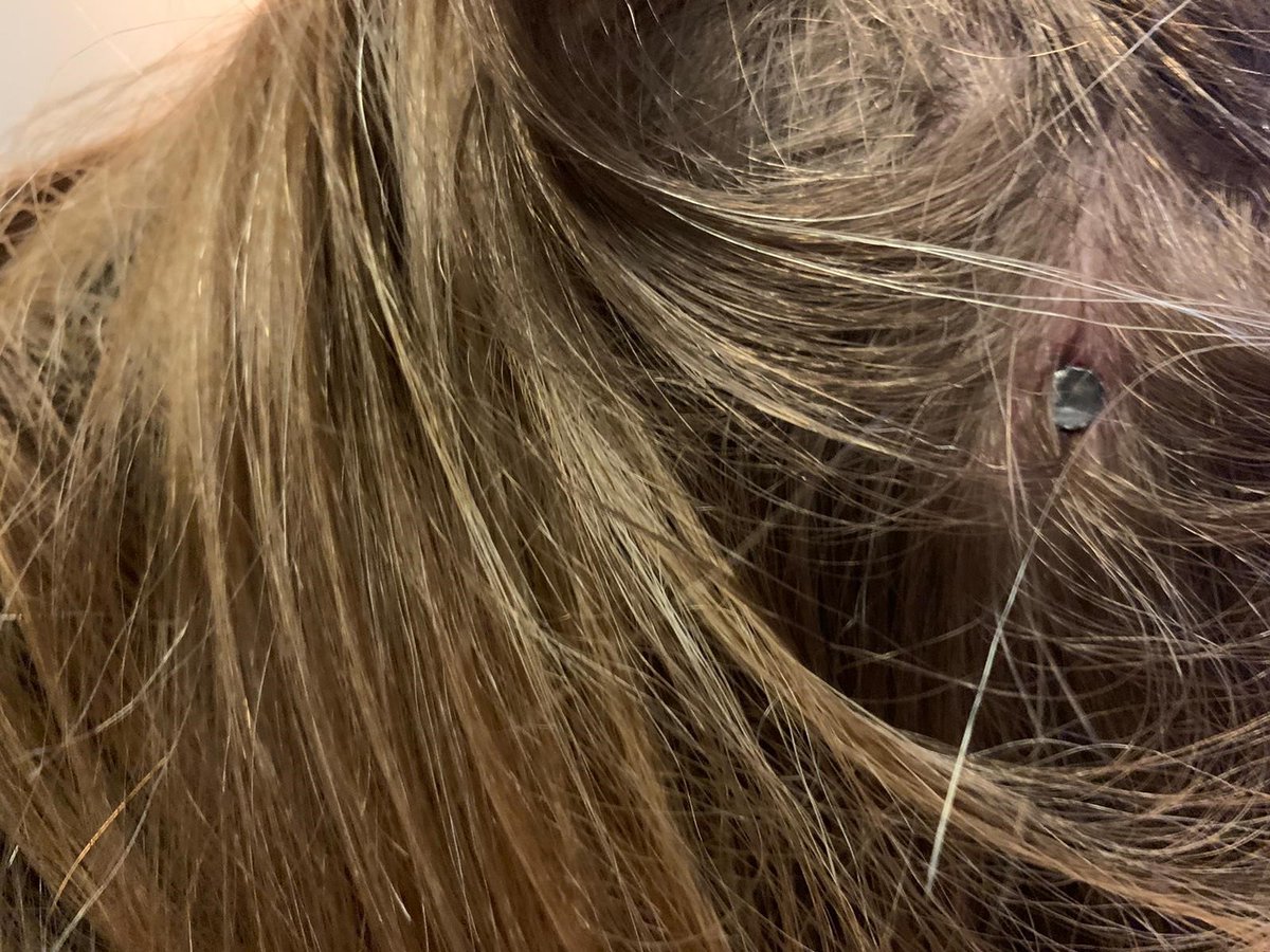 tsecrime's tweet image. RT @ClevelandPolice: 3 people hit by air gun pellets in Trimdon Avenue, #Acklam last night between 8:45-9:15pm. One girl had a pellet removed from her head in hospital. Anyone who knows anything, call 101 or @CrimestoppersUKsee: tinyurl.com/y9ndpmz6