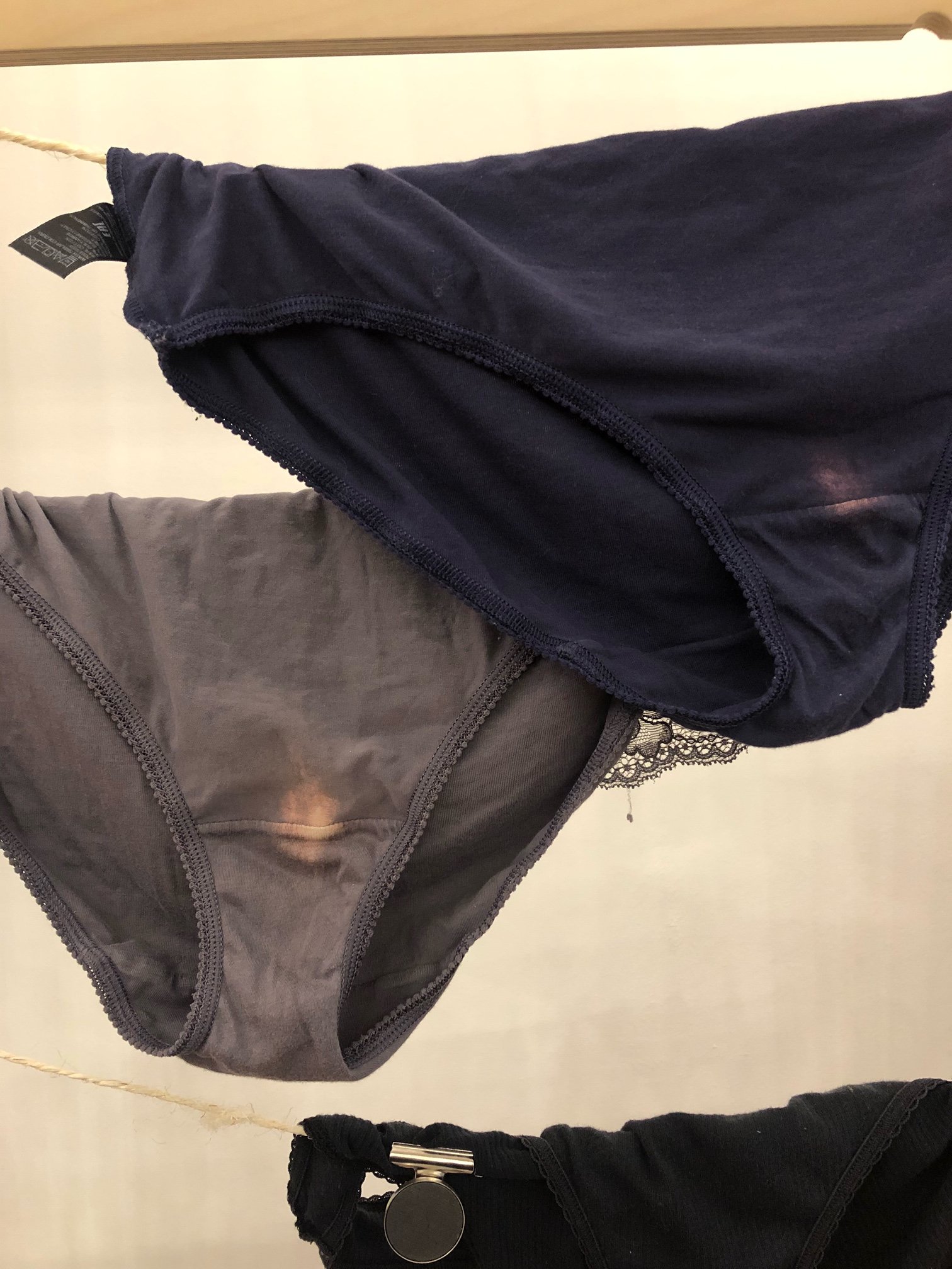 Vagina Museum Do You Find Lighter Patches In Your Dark Underwear It S Normal Your Vagina Is Acidic And Has A Ph Of 3 8 4 5 That S Acidic Enough To Bleach Fabric And