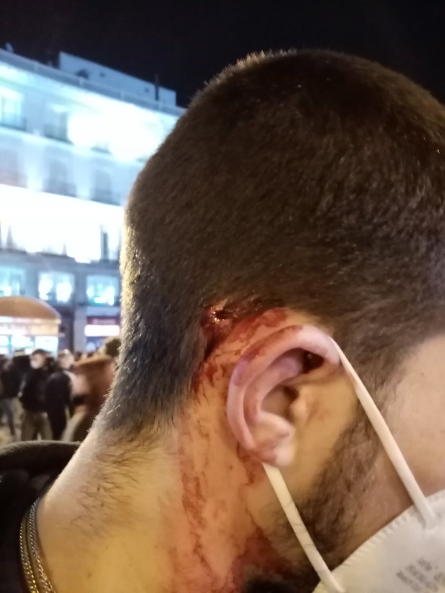 marcos_tb00's tweet photo. Acaba de pasar en Sol. La violencia policial sigue a la orden del día.
#LibertadPabloHasel
@AntirrepreMad
@LlibertatHasel https://t.co/xhvaKJI66x