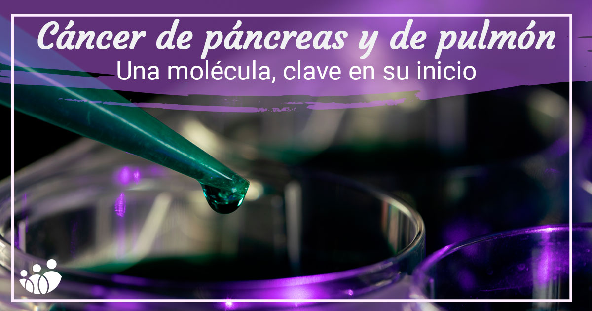 ACUNSA's tweet photo. Científicos del @CIMA_unav descubren un nuevo mecanismo relacionado con el #CáncerDePáncreas y #CáncerDePulmón.
Este hallazgo es muy relevante para el desarrollo de potenciales terapias. Conócelo en nuestro post. https://t.co/SIKXrmBZ2r
#ACUNSA #CUN #Salud #Cáncer https://t.co/qmKIHMP3cm