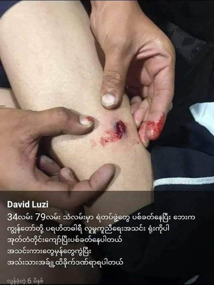 19Xee's tweet photo. At present, the people of Burma are in a very worrying situation.  We demand a military solution 
#SaveMyanmarCitizens 
#SaveBurmaDemocracy 
National League for Democracy7Day TVMyanmar NowNikkei AsiaPresident of IndiaAye Min MyintU.S. Embassy RangoonU Kyaw GyiUK in https://t.co/efYuXkTKwx