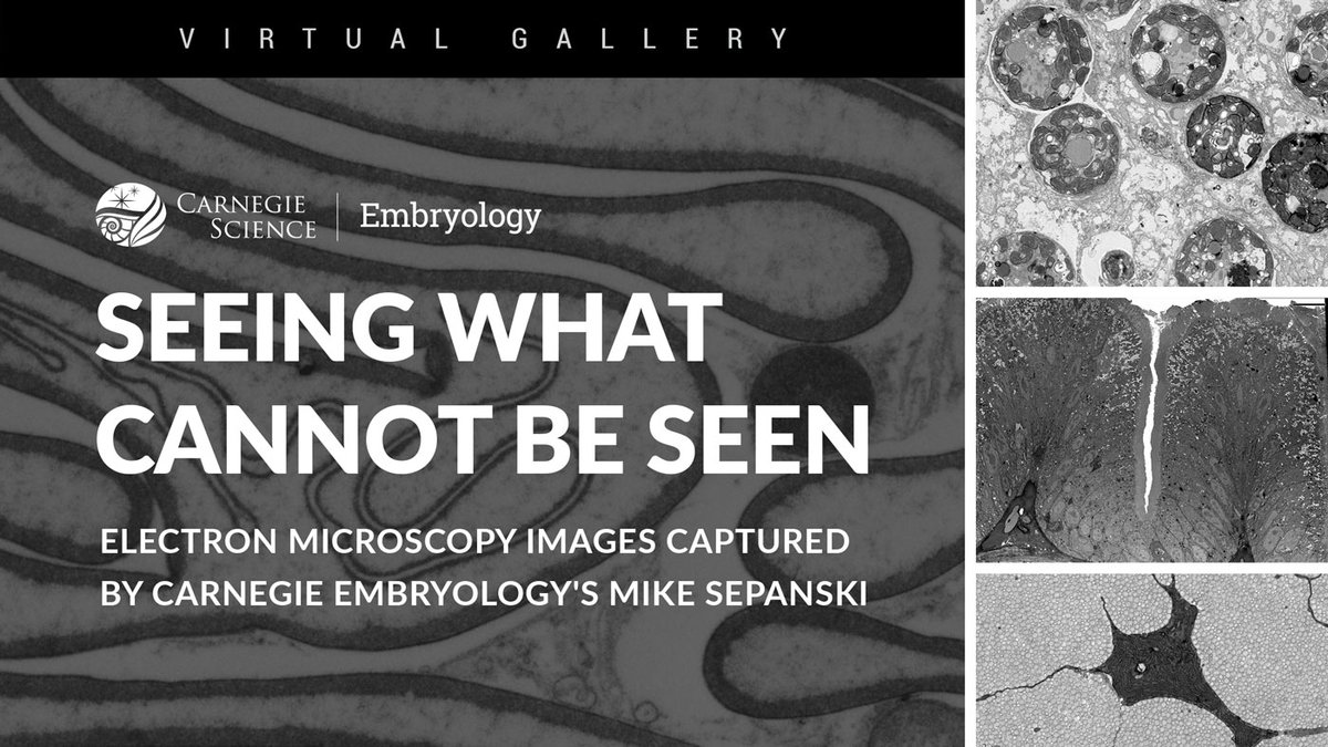 CarnegieDevBio's tweet image. In January, @carnegiedevbio&apos;s electron microscopist Mike Sepanski retired after a 37-year career. To celebrate his tremendous contributions to science at this department &amp;amp; beyond, we have put together a virtual gallery of his otherworldly images!

Explore: emb.carnegiescience.edu/sepanski-galle…