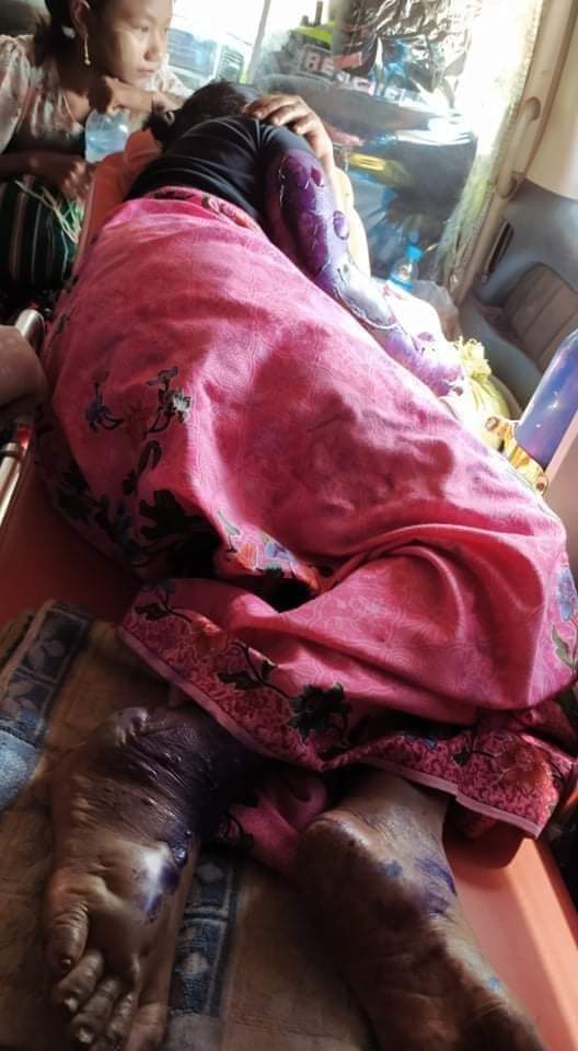 Zawmyoth's tweet photo. This is what's happening in Hpa an tonight. The Military ordered the prisoners to set fire Kyun Gyi village . Two children died and some injured seriously.
#WhatsHappeningInMyanmar
#17FebCoup
@BBCWorld @freya_cole @MayWongCNA @YourAnonCentral @KenRoth @RapporteurUn @cvoule https://t.co/JJ42WXCvBi