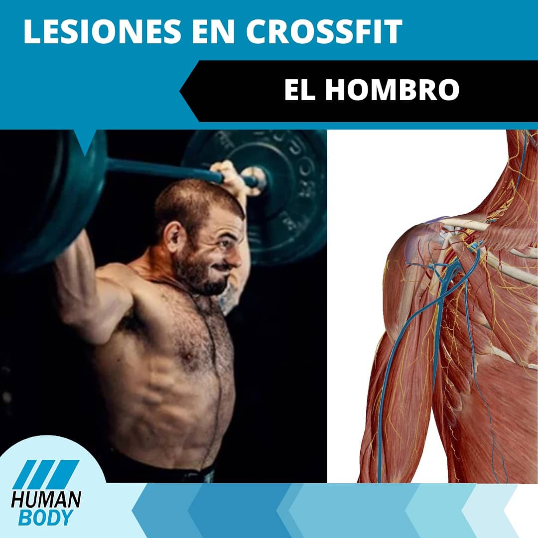HumanbodyFisio's tweet photo. 👍🏼 Siguiendo con el hilo de ayer, hoy te hablo de las lesiones de hombro y posibles dolores referidos de músculos sobrecargados o sobresolicitados que pueden venir derivadas del déficit de rango de movimiento.

Lee el artículo enero en nuestro IG.

#crossfit #lasrozas https://t.co/FG2NSbJpkZ