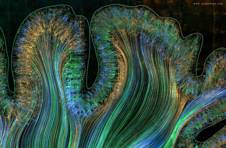 griz1's tweet photo. This could be very interesting!
#Neuroplasticity & the #AmazingBrain
@ABFbrain @AANPublic @UCLABrainSPORT @BrainandLifeMag @BrainRecoveryP @brain_trauma @neuroayogi @lindz4RandF @HMotanis
Tomorrow/Thursday 2/18/21 5pm PST/8pm EST
Register: https://t.co/VHASc7nktO https://t.co/QpmnHJehGB