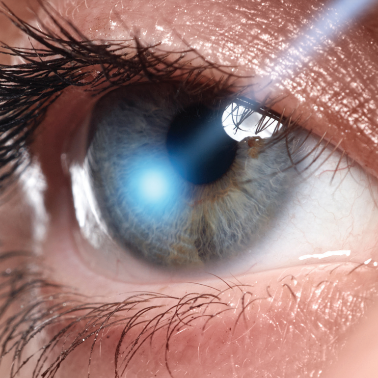 ModOptometry's tweet image. Read Dr. Aaron McNulty’s article, which looks at the reasons to choose laser treatment as a first-line therapeutic option for patients with glaucoma: hubs.ly/H0GPk5Y0.

#ModernOptometry #Optometry #Optometrist #EyeCare #EyeHealth #SLT #Glaucoma #GlaucomaTreatment