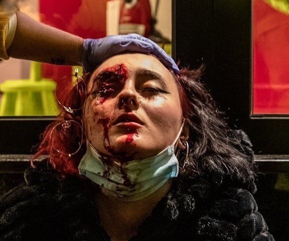 antirepre_pon's tweet photo. I encara ens demaneu que condemnen l'autodefensa?

#LlibertatPabloHasel https://t.co/buvjMNtUk9