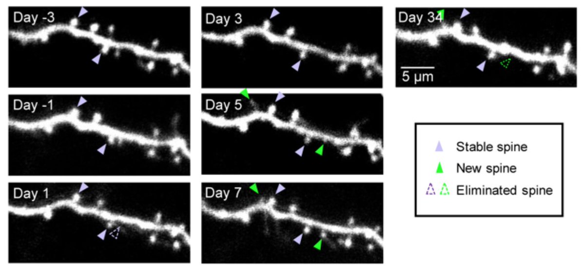 Alex Kwan 關進晞 (@kwanalexc) on Twitter photo A focused study from our lab to answer one question – what is the extent and time scale of effects of #psilocybin on dendritic architectures in vivo? Led by Lingxiao Shao with help from <a href="/ItsClaraLiao/">Clara Liao</a> @NeilSavalia and others. <a href="/YalePsych/">Yale Psychiatry</a> <a href="/YaleNeuro/">Yale Neuroscience</a> 1/7 A focused study from our lab to answer one question – what is the extent and time scale of effects of #psilocybin on dendritic architectures in vivo? Led by Lingxiao Shao with help from <a href="/ItsClaraLiao/">Clara Liao</a> @NeilSavalia and others. <a href="/YalePsych/">Yale Psychiatry</a> <a href="/YaleNeuro/">Yale Neuroscience</a> 1/7