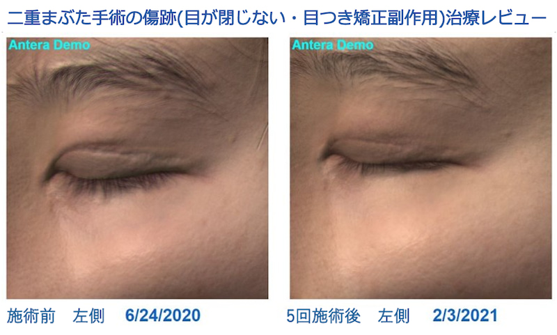 Clover Korea Cloverkorea Twitter