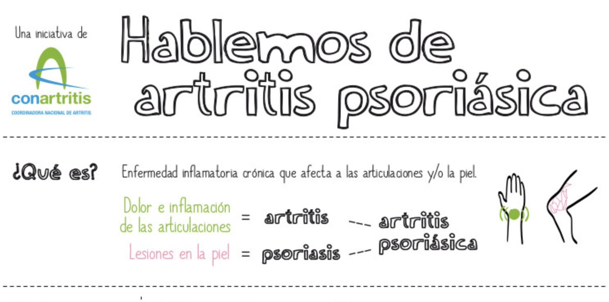 pfizer_spain's tweet photo. 💭¿Qué sienten las personas con #ArtritisPsoriásica?
Colaboramos con @ConArtritis en la campaña #HablemosdeAPS para visibilizar a los pacientes y desterrar algunas creencias erróneas sobre la enfermedad
🎥 En este vídeo nos explica su viaje 👉🏻https://t.co/GQnNNSh980 https://t.co/mwIffFjxBb