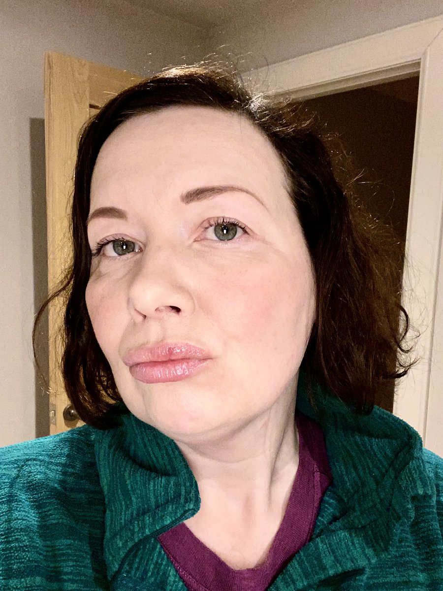 LunanBayFarm's tweet image. We now offer natural lip fillers, courtesy of our goats. All you need to do is grab one of our Bucks and they’ll repay you with a reverse Glasgow kiss. Once the pain subsides, hey presto perfect pout! 💋#farmlife #troutpout