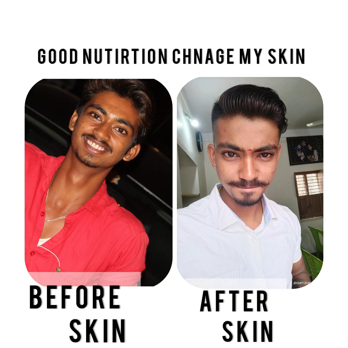 Sumanth95387275's tweet image. #skinchanges #Skin #oilskin