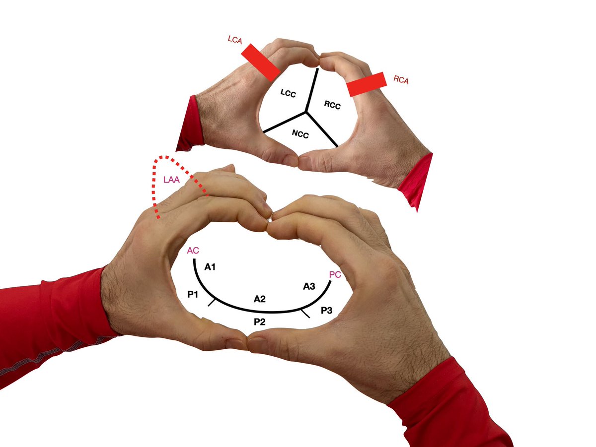 Prof Khaled Albouaini tweet media