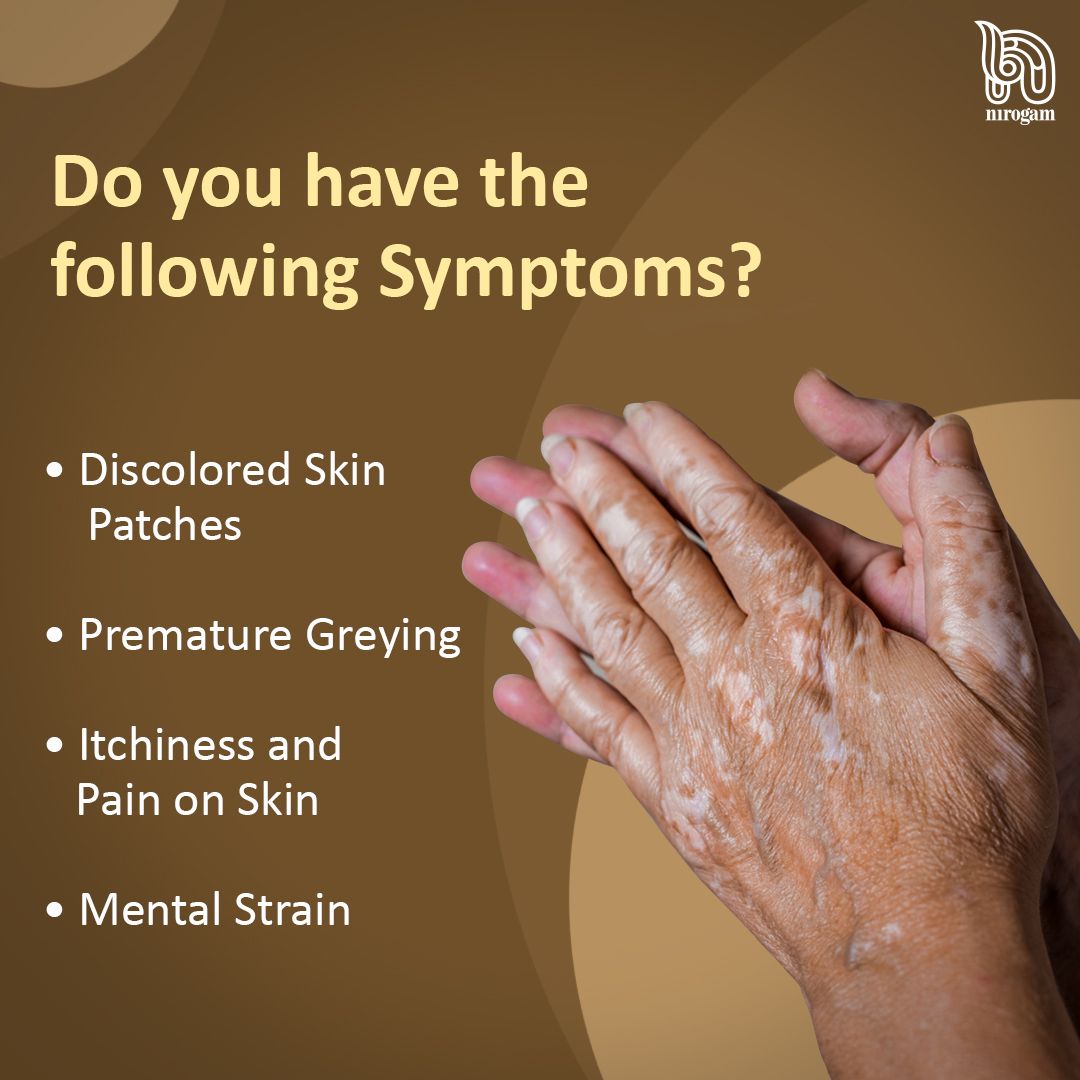 Nirogam's tweet photo. If you have any of the above symptoms you could have Vitiligo. Don’t ignore the symptoms, treat it before it gets out of hand.
.
.
.
.
#vitiligo #symptoms #vitiligobeauty #vitiligoawareness #vitiligomodel #vitiligonation #vitiligoworld #vitiligopride #ayurveda #nirogam https://t.co/Vjqqd36chX
