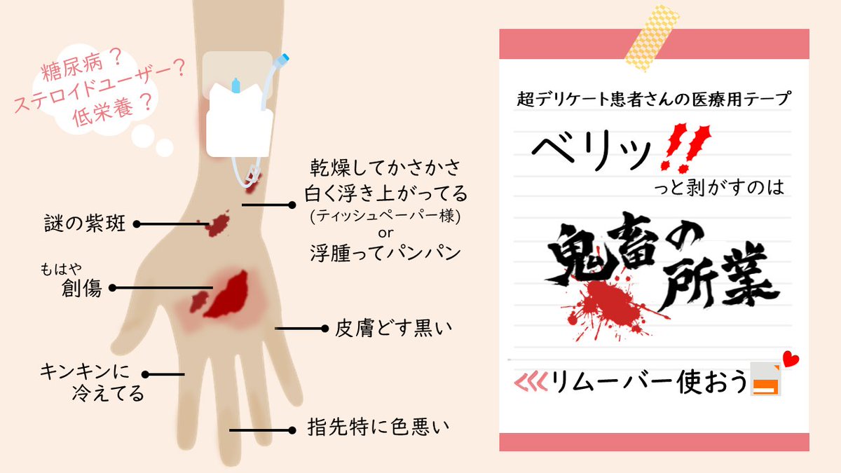 あおみどり ハイリスク患者さんに通称ワッショイ剥離 またの名をブラジリアンワックス 命名ワイ しようものなら確実に皮膚持ってかれる しかしicuで固定テープを使わないなんてことも不可能 テープ選択や貼り方にも注意です 脆弱皮膚の患者さんは あおみどり ハイリスク患者さんに通称ワッショイ剥離 またの名をブラジリアンワックス 命名ワイ しようものなら確実に皮膚持ってかれる しかしicuで固定テープを使わないなんてことも不可能 テープ選択や貼り方にも注意です 脆弱皮膚の患者さんは
