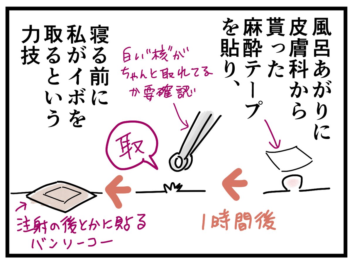 水イボと2年間闘った話3/4
本来イボを無理に取る必要はないんでしょうけど、本人が痒がる、見た目を気にして取りたがっている、なにより人に移してしまう可能性を考えて原点回帰しました。最初に数回皮膚科に通って取って貰ってたので、その時貰った麻酔テープを使って自宅で取りました。 