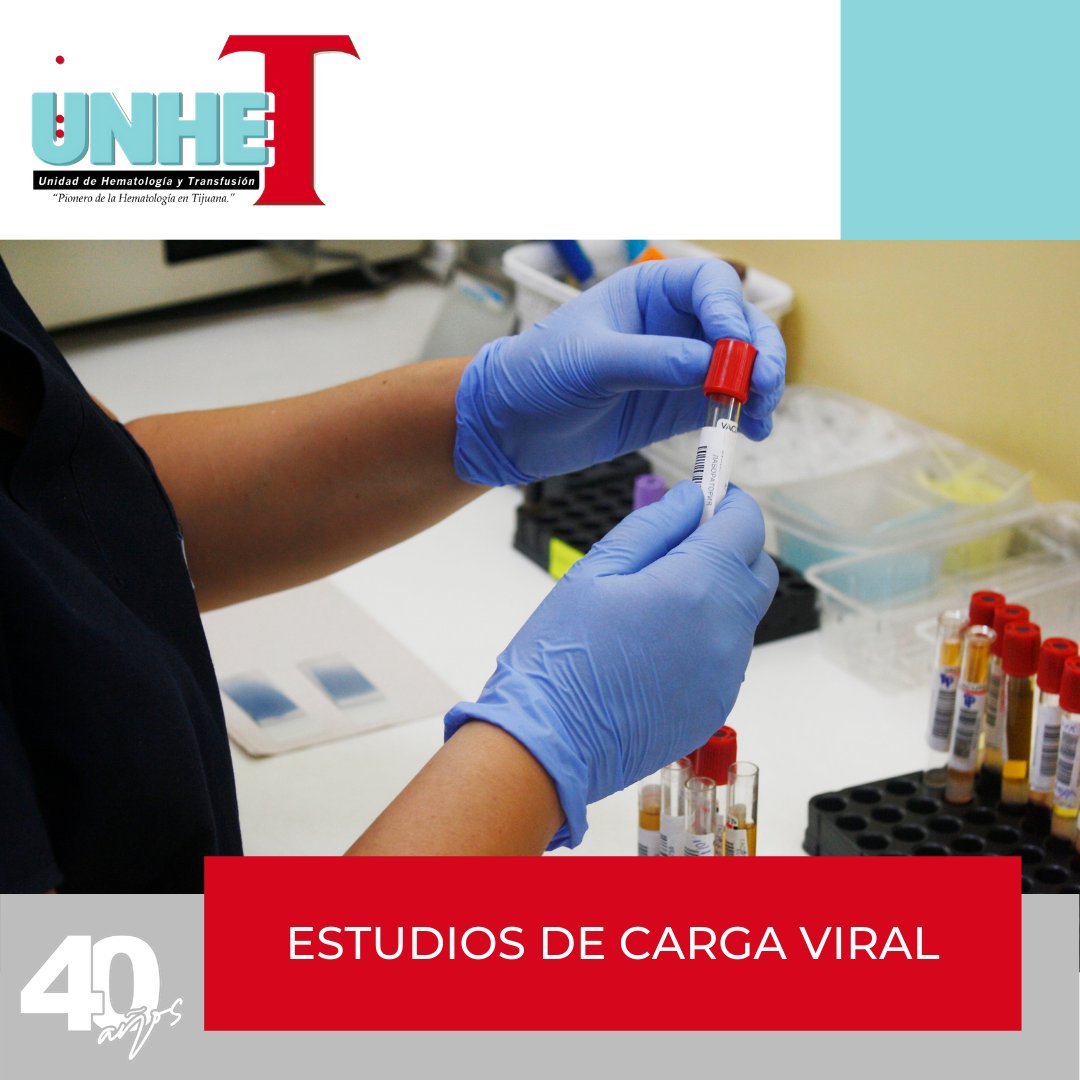UneteLab's tweet image. Estudios de Carga Viral para VIH y Hepatitis C

Pregunta por las indicaciones previas y has tu cita a los telefonos:
TIJUANA: Laboratorio: 📞664 103 6131
ROSARITO: Laboratorio: 📞661 124 1869

#AnalisisClinicos #Salud #COVID #VIH
