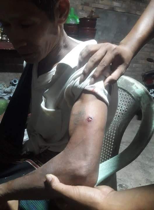 Moe04044860's tweet photo. In Dawei, the police came to arrest the leader of the protest against military,the head of the Student Union in Dawei!When the people negotiated not to arrest anyone,the police fire the guns into the crowd!More than 3 civilians is injuried!
#WhatsHappeningInMyanmar
#Feb18Coup https://t.co/L5gafn6SsK