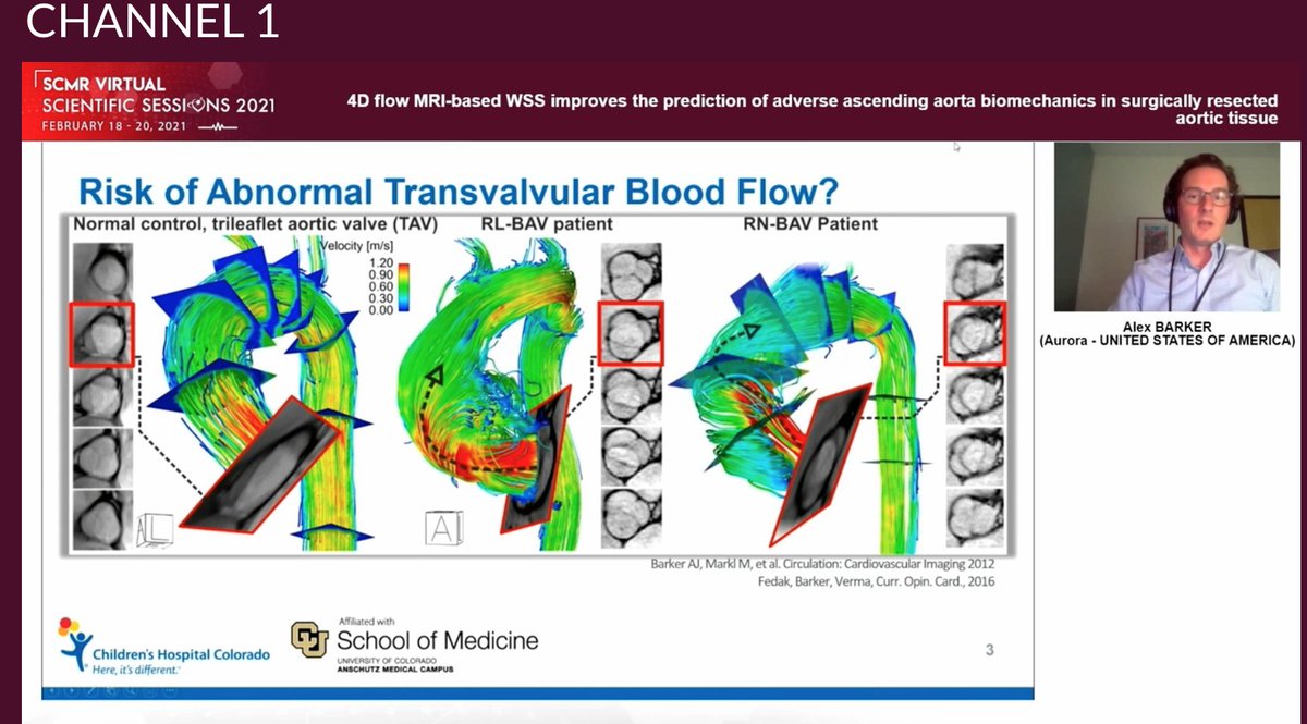 Different patterns of #4Dflow #whyCMR in bicuspid aortic valve disease