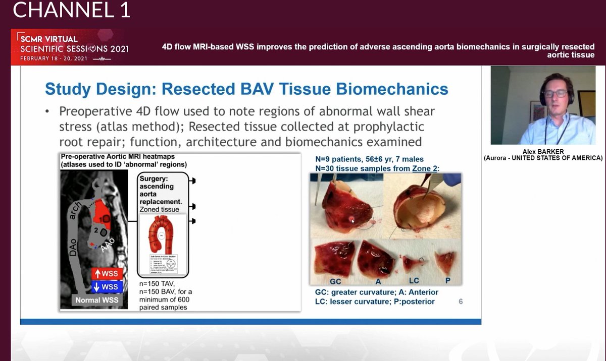 #whyCMR #4Dflow WSS predicts elastin fragmentation of explanted aortic tissue