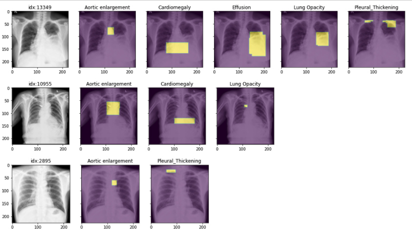 Looking for pathology masks for #chestxray images?
5 datasets with masks + same API
Let's build the future!
Demo notebook: github.com/mlmed/torchxra…