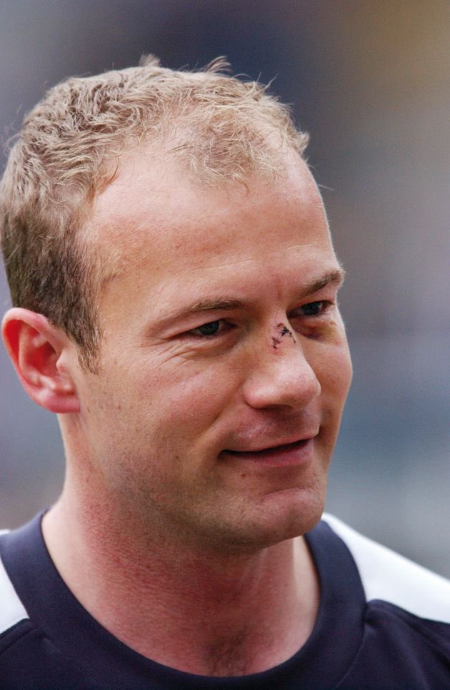 6: HairWrigi has had many trademark hairstyles which only add to his overall game. His dread era or blonde hair era rained terror over the league, while Shearer was bald at 30. Wrigis hair gave him an advantage, as his dreads added unpredictability to his heading.