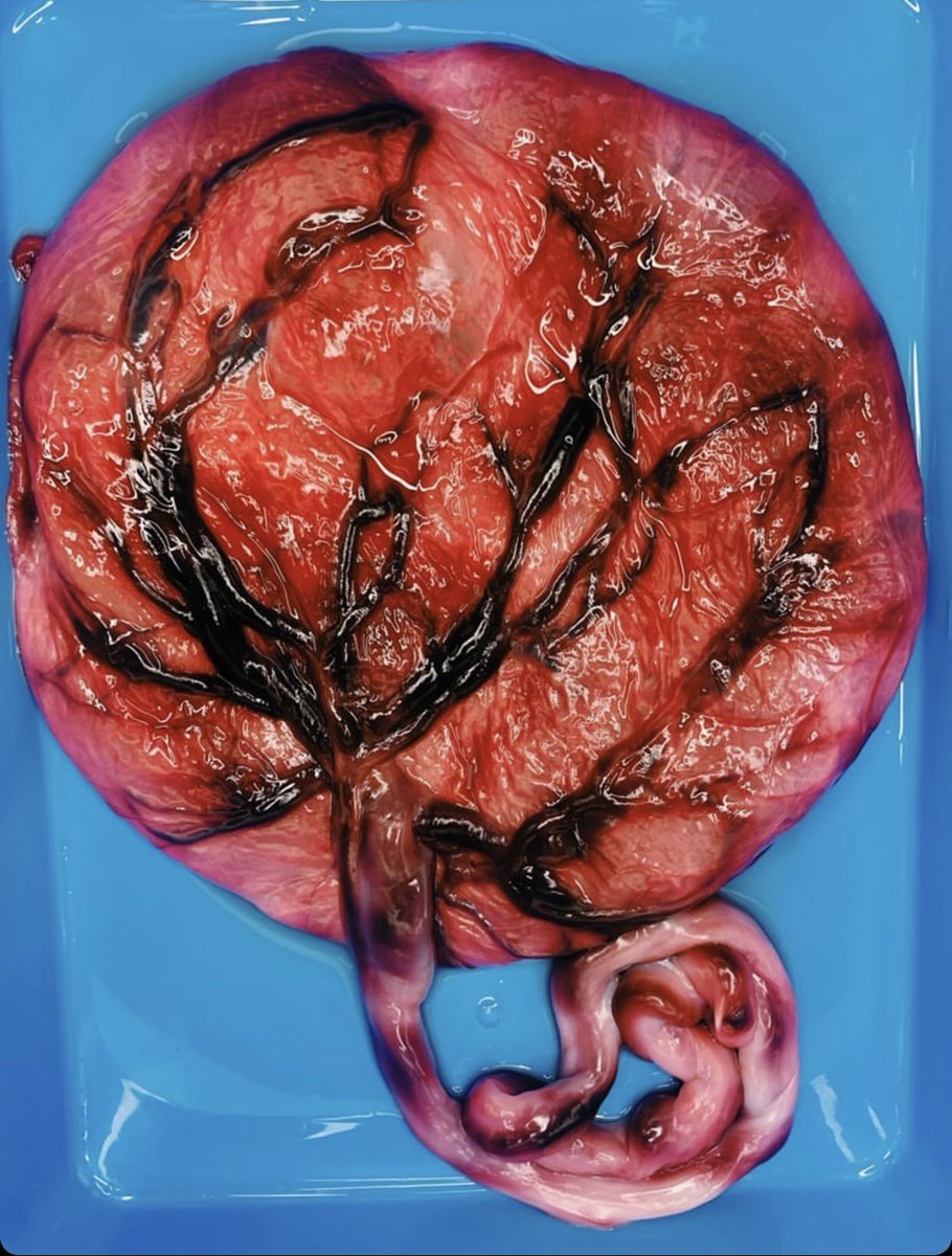 My placenta then & now 