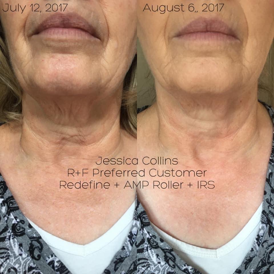 Rodan_Fields_rd's tweet photo. 😍 𝗧𝗢𝗢𝗟𝗦 𝗮𝗿𝗲 𝗼𝗻 𝘀𝗮𝗹𝗲 𝗳𝗼𝗿 𝟯𝟱% 𝗼𝗳𝗳!  𝗢𝗻𝗹𝘆 𝘂𝗻𝘁𝗶𝗹 𝟮/𝟭𝟵! 😍. Preferred customers, add another 10% to the sale! https://t.co/IFcGtJPCi4