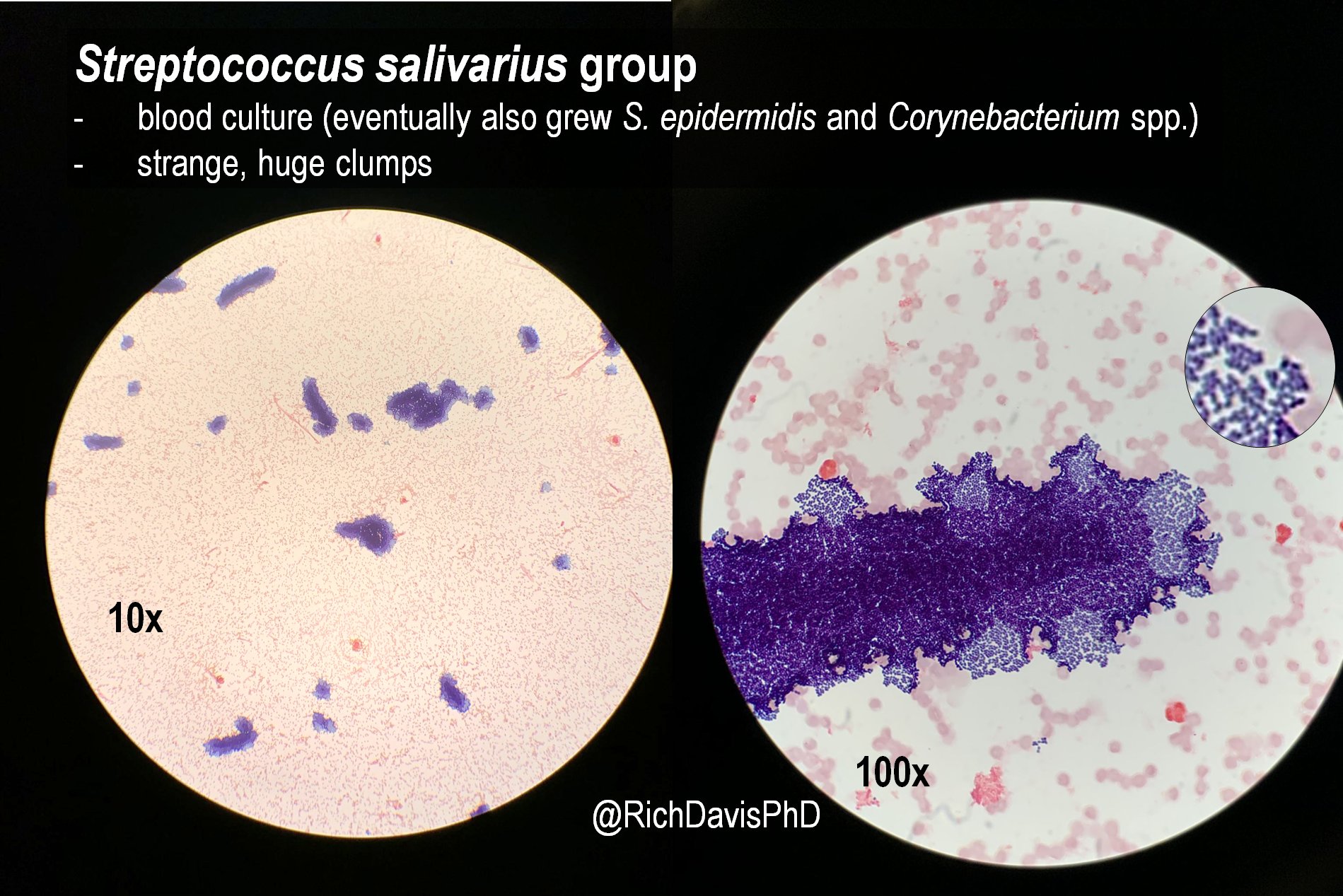 Streptococcus Salivarius 1000x