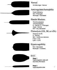 9/13 Also pattern recognition is important (learned with practice...)