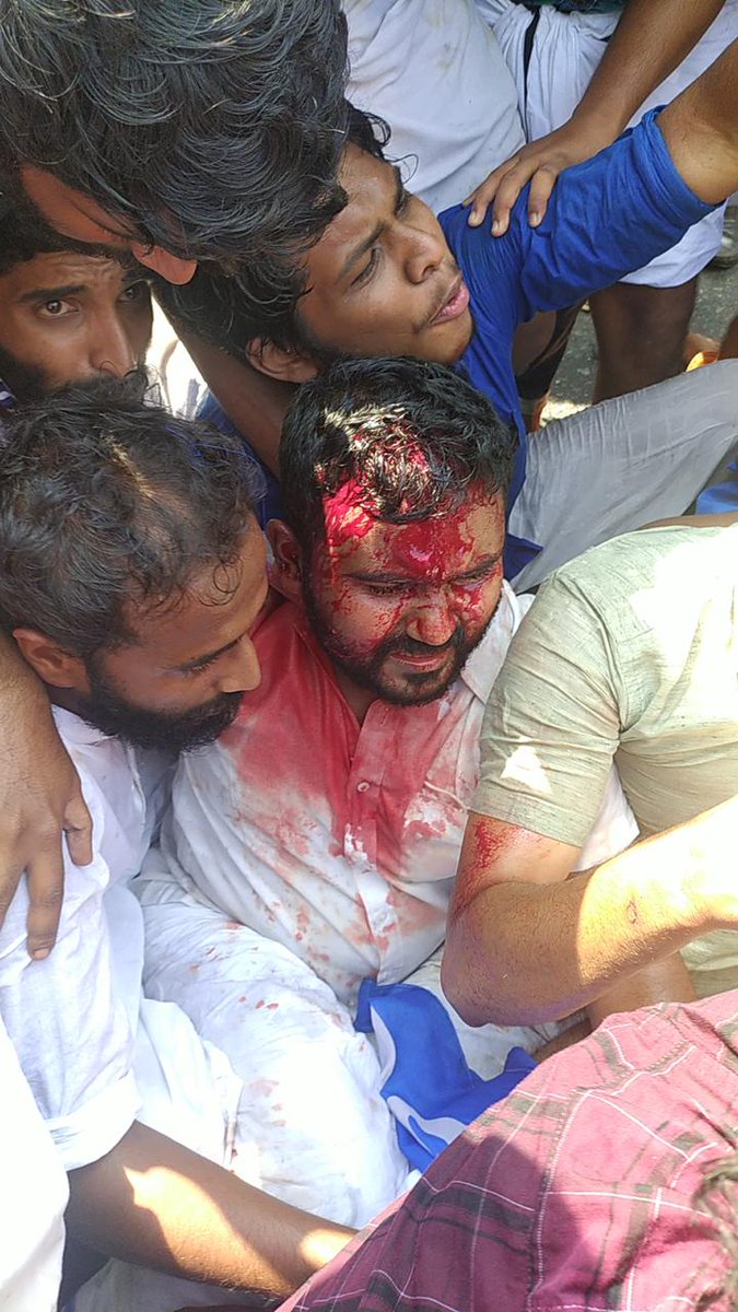 yashir_nawaz's tweet photo. केरल में @nsui के पदाधिकारियों पर पुलिस द्वारा बर्बरता पूर्वक किए गए लाठीचार्ज घोर निंदनीय है। इस हमले में छात्र कांग्रेस के राष्ट्रीय सचिव @Ericjusa जी गंभीर रूप से चोट से घायल हुए है। मैं उनके यथा शीघ्र स्वस्थ होने की कामना करता हूँ। https://t.co/HfWdhsn7cX