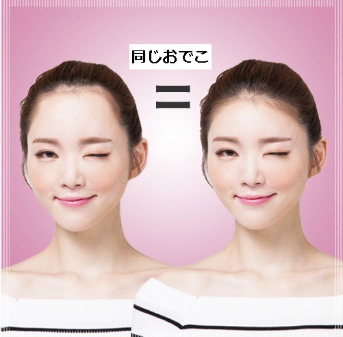 ヘアライン矯正 Twitter Search Twitter ヘアライン矯正 Twitter Search Twitter