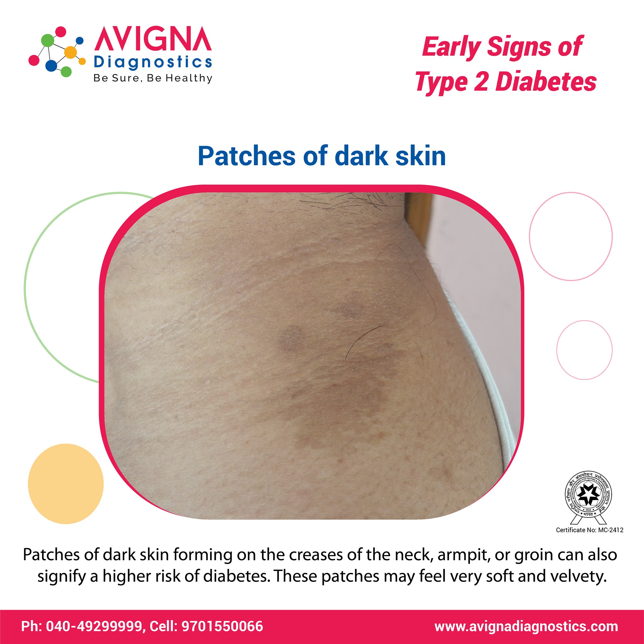 Dark patches on sale on skin
