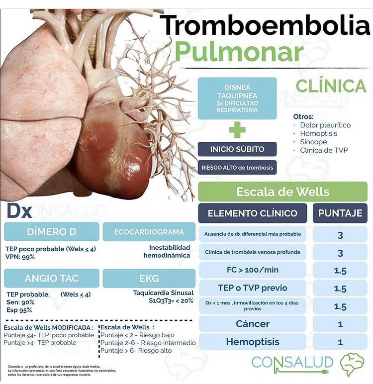 Draojitos97's tweet photo. Recolección de flash cards de NEUMOLOGIA DE CONSALUD. #enarm #flashmed https://t.co/BykIXXHJWm
