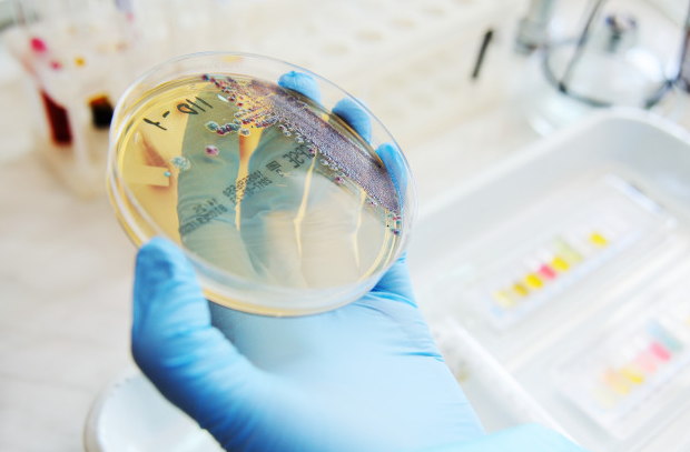 В ходе биологической эксперимента в чашку петри. Агар агар в чашке петри. В ходе биологической эксперимента в чашку петри. Чашка петри микробиология. Колонии бактерий в чашке петри.