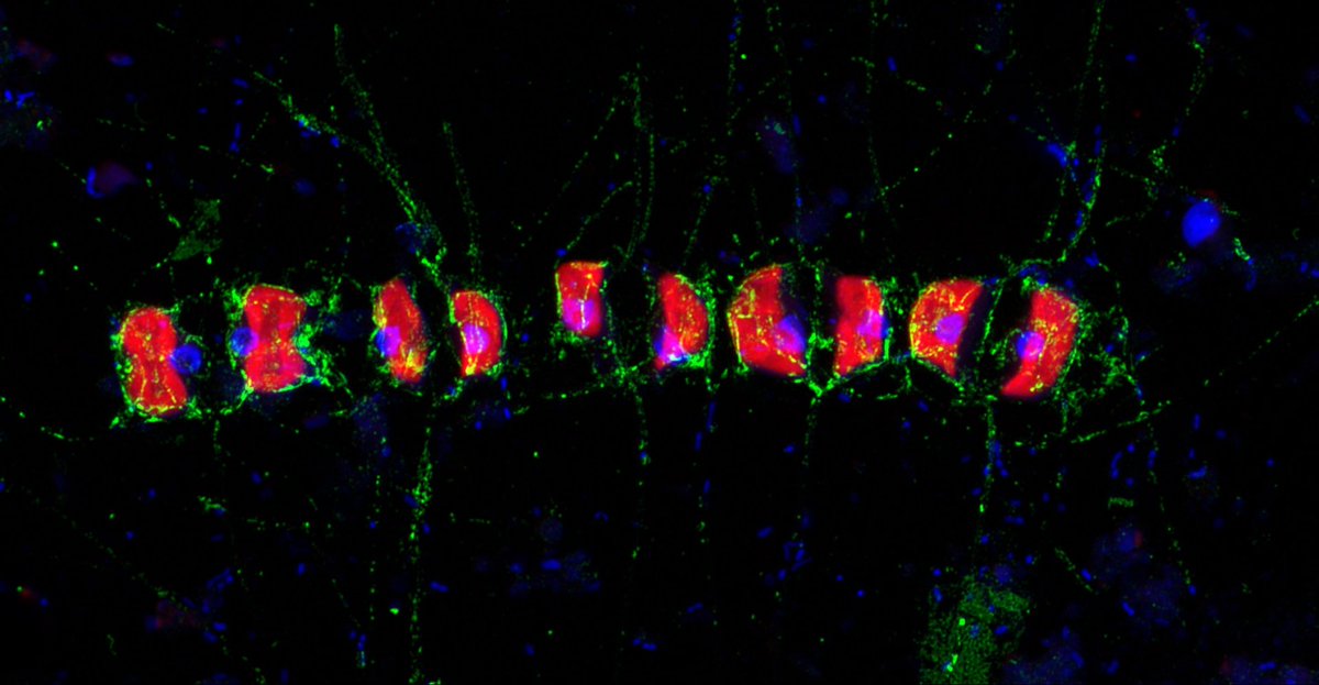 MarineMicrobio's tweet photo. So sweet, yet so unattainable: An algal sugar resisting rapid microbial degradation could act as #carbon sink.
Read the paper by @SVidalMelgosa now out in @NatureComms
#diatom #fucan #polysaccharide #microarray #fcsp #Glycobio
https://t.co/Db2XgTGI43
https://t.co/iOvgyCeyeN https://t.co/dHFsu9iagO