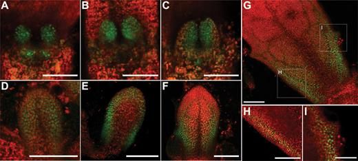 JXBot's tweet image. SAW homeodomain transcription factors regulate initiation of leaf margin serrations bit.ly/3p3SzrW Hyung-Woo Jeon &amp;amp; Mary E Byrne @Sydney_Uni
#Arabidopsis #serration #leaf