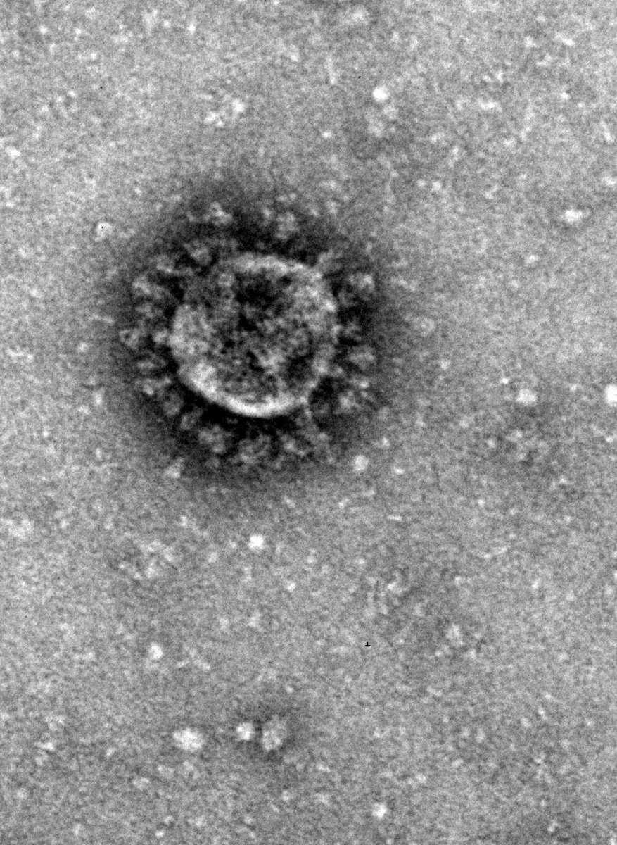 iviromics's tweet photo. Ayer estuvimos analizando partículas de #SARSCoV2 al microscopio electrónico. La tinción negativa permite visualizar perfectamente la corona de spikes https://t.co/Q7zjYShyr6