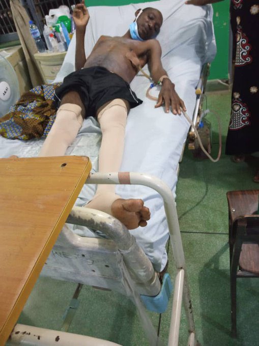 _Olaitan_'s tweet photo. Thank you for the help so far guys, we are almost there. #SaveTaiwo
Target: N1,832,000
Amount Raised: N850,700.
Please keep RTing and donating. God bless you.
2191322761
Zenith Bank
Taiwo Idris
🙏🙏 https://t.co/8d8BgubQRb