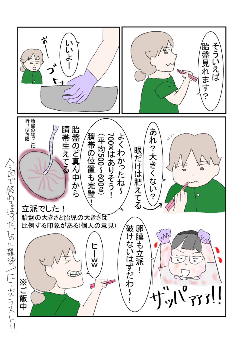 出産レポその⑭
娩出後~その他いろいろあって最後ではない
#出産レポ #正直出産ってどうだったか教えて #誘発分娩