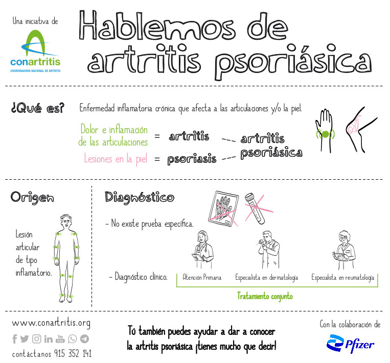 ConArtritis's tweet photo. Conceptos básicos, pero que muchas personas desconocen de la #artritispsoriásica🤷🏼♀️
Es una #enfermedadreumática autoinmune con identidad propia
🙅No es un síntoma de la #psoriasis
🙅No es una evolución de la #artritisreumatoide
¿Sabías esto?¿tienes dudas?
#HablemosdeAPs https://t.co/dYxesOy5hz